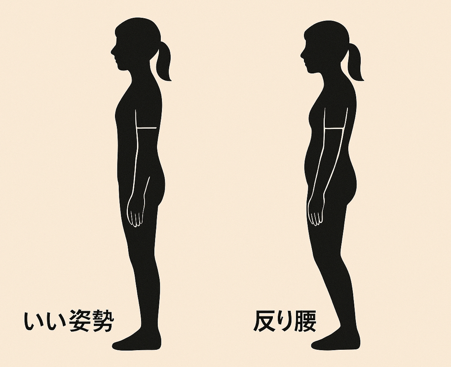 「それ、本当にいい姿勢?実は多い“反り腰”の落とし穴」